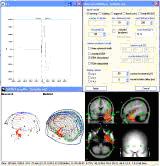 Neuroscan Source v2 TM溯源分析定位软件
