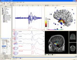 Neuroscan CURRY多模式神经影像
